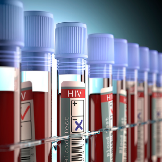 Blood testing for HIV